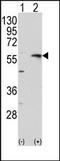 Collagenase 3 antibody, AP13170PU-N, Origene, Western Blot image 