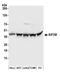 Eukaryotic Translation Initiation Factor 3 Subunit M antibody, A304-761A, Bethyl Labs, Western Blot image 