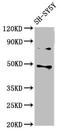 Casein Kinase 1 Epsilon antibody, LS-C211140, Lifespan Biosciences, Western Blot image 