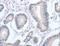 Apurinic/Apyrimidinic Endodeoxyribonuclease 1 antibody, LS-C403813, Lifespan Biosciences, Immunohistochemistry paraffin image 