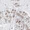 Outer Dense Fiber Of Sperm Tails 2 Like antibody, PA5-55751, Invitrogen Antibodies, Immunohistochemistry frozen image 