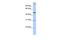 Acyl-CoA Binding Domain Containing 5 antibody, GTX46593, GeneTex, Western Blot image 