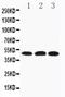 Hyaluronidase 3 antibody, PA1856, Boster Biological Technology, Western Blot image 