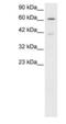 Inositol Polyphosphate-5-Phosphatase K antibody, PA1-24457, Invitrogen Antibodies, Western Blot image 