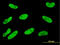 Serum/Glucocorticoid Regulated Kinase 1 antibody, LS-B5533, Lifespan Biosciences, Immunofluorescence image 