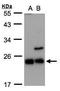 Core-Binding Factor Subunit Beta antibody, PA5-28505, Invitrogen Antibodies, Western Blot image 