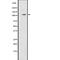 Ire1-alpha antibody, abx215233, Abbexa, Western Blot image 