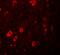 Zinc finger and BTB domain-containing protein 3 antibody, A14164, Boster Biological Technology, Immunofluorescence image 