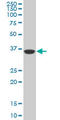 PDZ Binding Kinase antibody, LS-C133784, Lifespan Biosciences, Western Blot image 