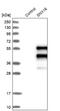 Sorting Nexin 16 antibody, NBP1-85972, Novus Biologicals, Western Blot image 