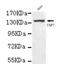 Ubiquitin Specific Peptidase 7 antibody, LS-C178326, Lifespan Biosciences, Western Blot image 