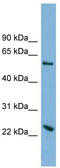 Transmembrane Protein 161A antibody, TA342038, Origene, Western Blot image 