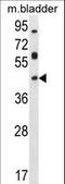 Homeobox D13 antibody, LS-C164992, Lifespan Biosciences, Western Blot image 