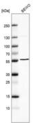 UDP-GlcNAc:BetaGal Beta-1,3-N-Acetylglucosaminyltransferase 2 antibody, NBP1-88951, Novus Biologicals, Western Blot image 