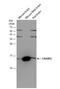 Cellular Retinoic Acid Binding Protein 2 antibody, NBP2-15998, Novus Biologicals, Western Blot image 