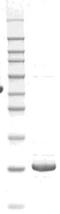 Thyroid Stimulating Hormone Subunit Beta antibody, TA354511, Origene, Western Blot image 