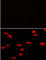 Lysine Methyltransferase 5A antibody, abx025168, Abbexa, Western Blot image 