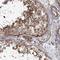 THAP Domain Containing 9 antibody, NBP1-93848, Novus Biologicals, Immunohistochemistry frozen image 