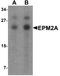 Laforin antibody, A00715, Boster Biological Technology, Western Blot image 