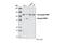 Poly(ADP-Ribose) Polymerase 1 antibody, 9532S, Cell Signaling Technology, Western Blot image 