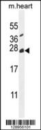 TNF Alpha Induced Protein 8 Like 2 antibody, 55-796, ProSci, Western Blot image 