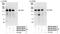 Insulin Receptor Substrate 2 antibody, NB100-68244, Novus Biologicals, Western Blot image 