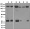 Integrin Subunit Alpha V antibody, TA310958, Origene, Western Blot image 