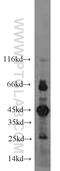 Folliculin antibody, 11236-2-AP, Proteintech Group, Western Blot image 