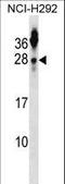 Tetraspanin 2 antibody, LS-C160264, Lifespan Biosciences, Western Blot image 