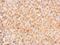 Mannosidase Endo-Alpha antibody, PA5-32000, Invitrogen Antibodies, Immunohistochemistry paraffin image 