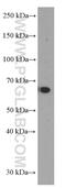Matrix Metallopeptidase 3 antibody, 66338-1-Ig, Proteintech Group, Western Blot image 