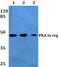 Protein Kinase CAMP-Dependent Type I Regulatory Subunit Alpha antibody, PA5-75223, Invitrogen Antibodies, Western Blot image 