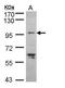 TNNI3 Interacting Kinase antibody, TA308400, Origene, Western Blot image 