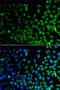  antibody, STJ29502, St John