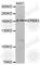 Erb-B2 Receptor Tyrosine Kinase 3 antibody, A5545, ABclonal Technology, Western Blot image 