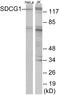 Nuclear Export Mediator Factor antibody, EKC1640, Boster Biological Technology, Western Blot image 