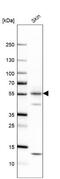 Keratin 1 antibody, NBP2-49378, Novus Biologicals, Western Blot image 