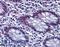 Checkpoint Kinase 2 antibody, LS-B6213, Lifespan Biosciences, Immunohistochemistry frozen image 