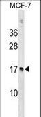 Nudix Hydrolase 4 antibody, LS-C158433, Lifespan Biosciences, Western Blot image 