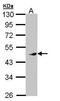 MAPK Activated Protein Kinase 5 antibody, GTX108759, GeneTex, Western Blot image 