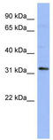 T Cell Leukemia Homeobox 1 antibody, TA343542, Origene, Western Blot image 