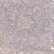 Protein Phosphatase 1 Regulatory Subunit 3B antibody, HPA028731, Atlas Antibodies, Immunohistochemistry paraffin image 