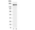 CD11b antibody, R31044, NSJ Bioreagents, Western Blot image 