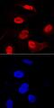 Beta-Transducin Repeat Containing E3 Ubiquitin Protein Ligase antibody, MAB7675, R&D Systems, Immunohistochemistry frozen image 