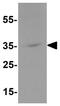 Potassium Two Pore Domain Channel Subfamily K Member 1 antibody, GTX31601, GeneTex, Western Blot image 
