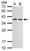 Ribosomal Protein Lateral Stalk Subunit P0 antibody, NBP2-20220, Novus Biologicals, Western Blot image 