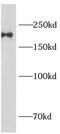 CD11b antibody, FNab01410, FineTest, Immunohistochemistry paraffin image 