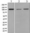 Fibroblast Growth Factor Receptor 3 antibody, ab137084, Abcam, Western Blot image 