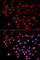 Cyclin Dependent Kinase 9 antibody, A1564, ABclonal Technology, Immunofluorescence image 