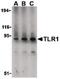 Toll-like receptor 1 antibody, PA5-20181, Invitrogen Antibodies, Western Blot image 